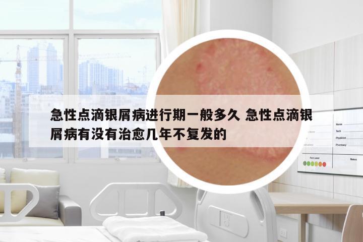 急性點(diǎn)滴銀屑病進(jìn)行期一般多久 急性點(diǎn)滴銀屑病有沒有治愈幾年不復(fù)發(fā)的
