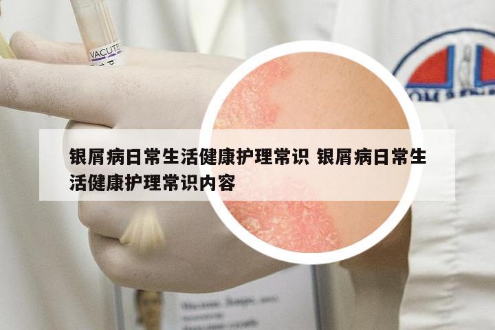 銀屑病日常生活健康護(hù)理常識(shí) 銀屑病日常生活健康護(hù)理常識(shí)內(nèi)容