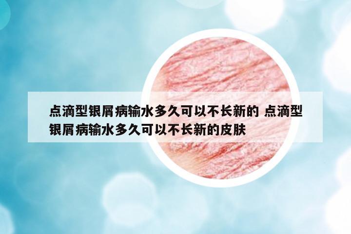 點(diǎn)滴型銀屑病輸水多久可以不長(zhǎng)新的 點(diǎn)滴型銀屑病輸水多久可以不長(zhǎng)新的皮膚
