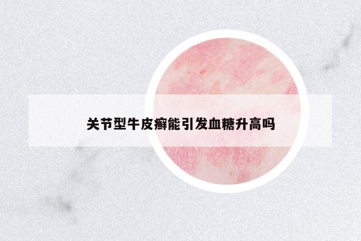 關(guān)節(jié)型牛皮癬能引發(fā)血糖升高嗎