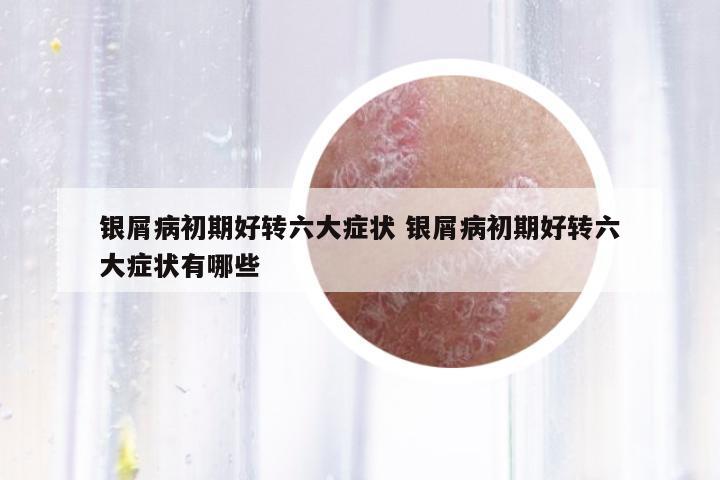 銀屑病初期好轉(zhuǎn)六大癥狀 銀屑病初期好轉(zhuǎn)六大癥狀有哪些