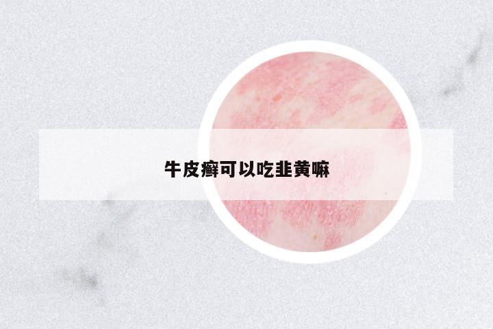 牛皮癬可以吃韭黃嘛