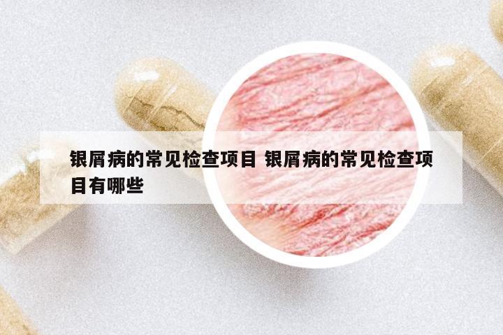 銀屑病的常見檢查項(xiàng)目 銀屑病的常見檢查項(xiàng)目有哪些