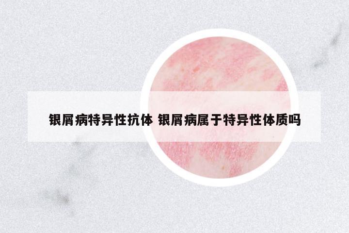 銀屑病特異性抗體 銀屑病屬于特異性體質(zhì)嗎