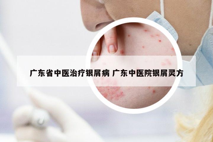 廣東省中醫(yī)治療銀屑病 廣東中醫(yī)院銀屑靈方