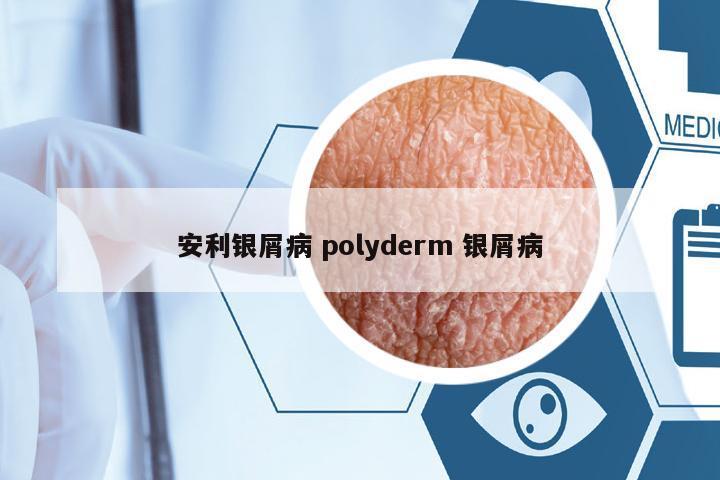 安利銀屑病 polyderm 銀屑病