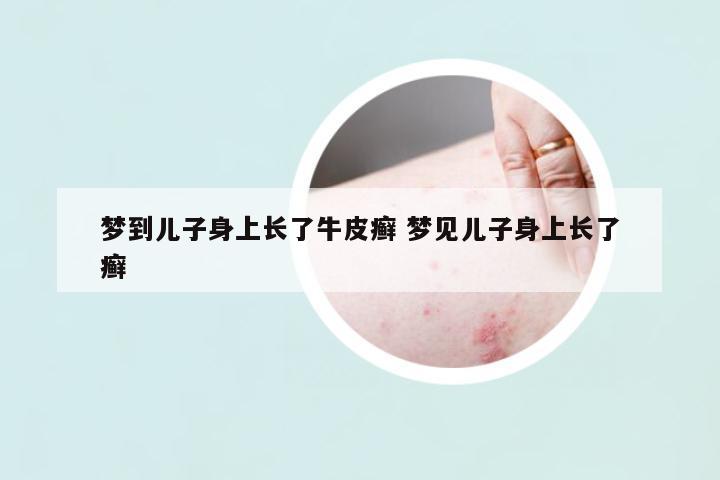 夢(mèng)到兒子身上長(zhǎng)了牛皮癬 夢(mèng)見(jiàn)兒子身上長(zhǎng)了癬