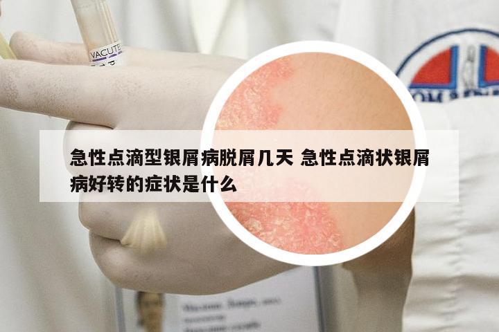 急性點(diǎn)滴型銀屑病脫屑幾天 急性點(diǎn)滴狀銀屑病好轉(zhuǎn)的癥狀是什么