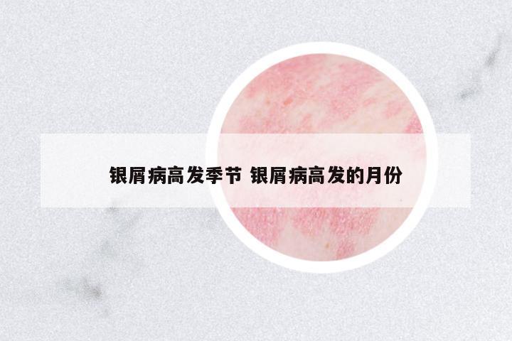 銀屑病高發(fā)季節(jié) 銀屑病高發(fā)的月份