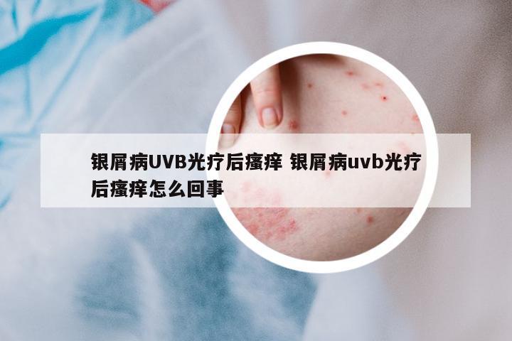 銀屑病UVB光療后瘙癢 銀屑病uvb光療后瘙癢怎么回事