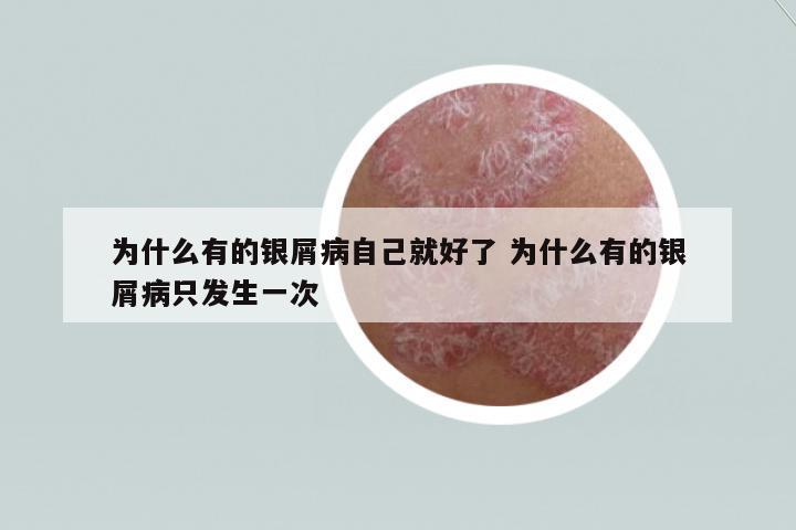 為什么有的銀屑病自己就好了 為什么有的銀屑病只發(fā)生一次