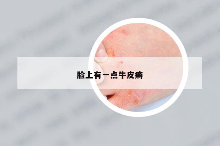 臉上有一點牛皮癬