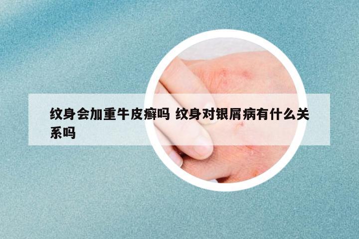 紋身會加重牛皮癬嗎 紋身對銀屑病有什么關系嗎