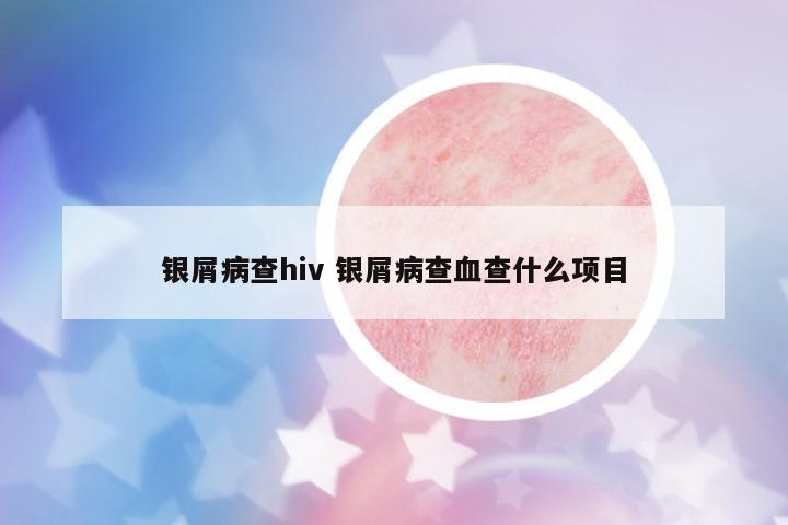 銀屑病查hiv 銀屑病查血查什么項目