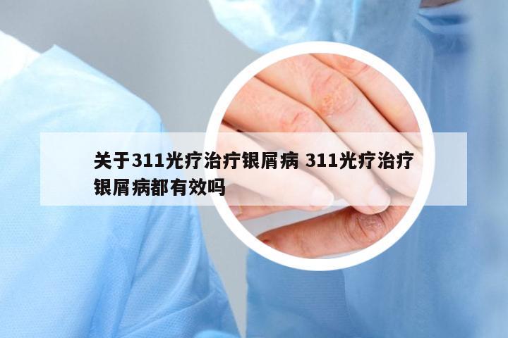 關(guān)于311光療治疔銀屑病 311光療治療銀屑病都有效嗎