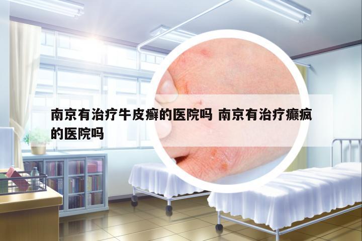 南京有治療牛皮癬的醫(yī)院嗎 南京有治療癲瘋的醫(yī)院嗎
