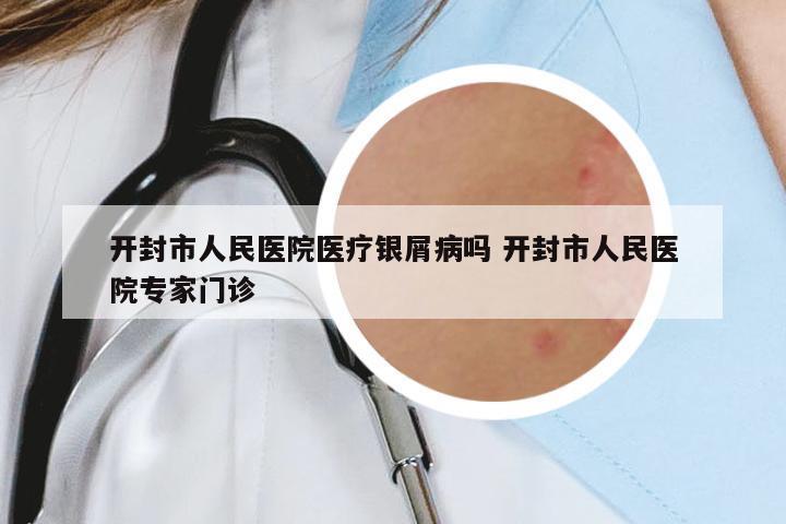 開(kāi)封市人民醫(yī)院醫(yī)療銀屑病嗎 開(kāi)封市人民醫(yī)院專家門(mén)診