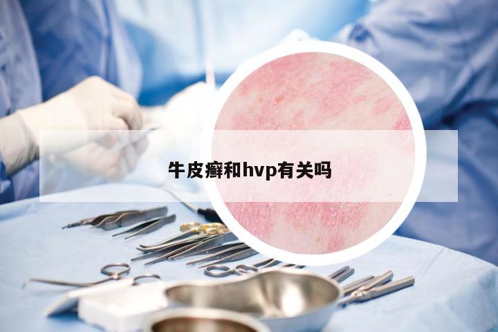 牛皮癬和hvp有關(guān)嗎