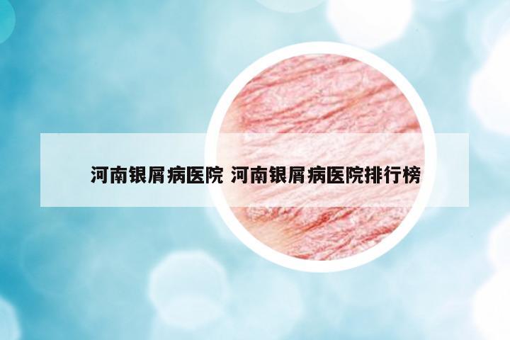 河南銀屑病醫(yī)院 河南銀屑病醫(yī)院排行榜