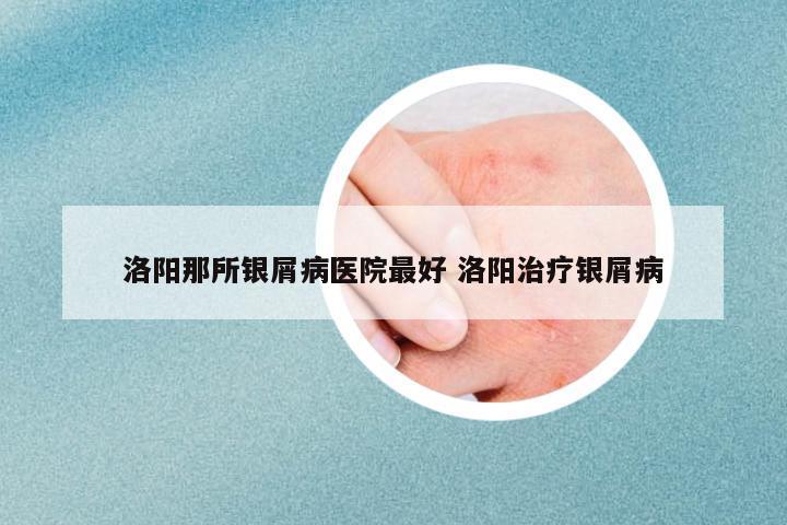 洛陽那所銀屑病醫(yī)院最好 洛陽治療銀屑病