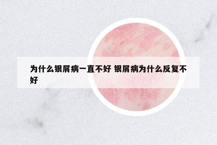 為什么銀屑病一直不好 銀屑病為什么反復(fù)不好