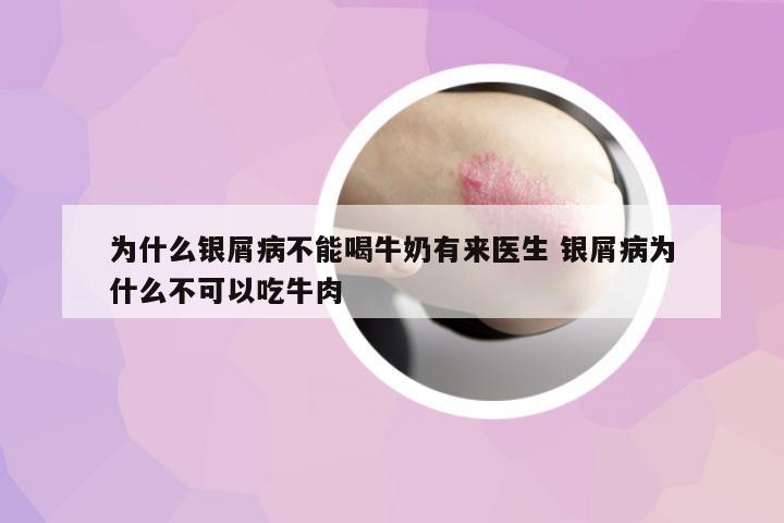 為什么銀屑病不能喝牛奶有來醫(yī)生 銀屑病為什么不可以吃牛肉