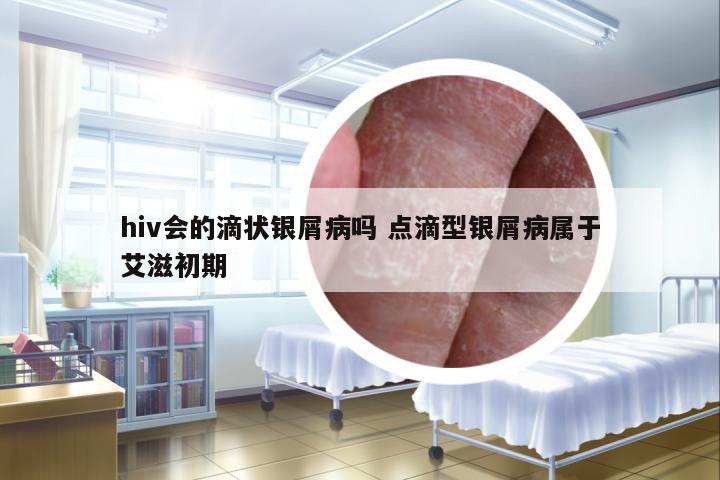 hiv會的滴狀銀屑病嗎 點滴型銀屑病屬于艾滋初期