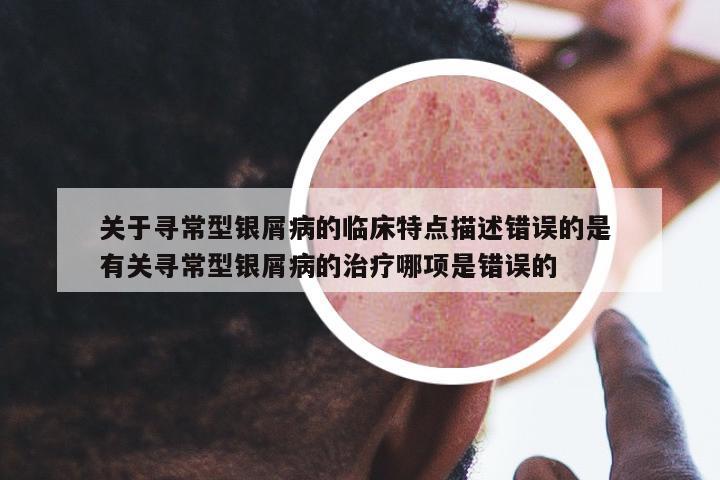 關(guān)于尋常型銀屑病的臨床特點(diǎn)描述錯(cuò)誤的是 有關(guān)尋常型銀屑病的治療哪項(xiàng)是錯(cuò)誤的