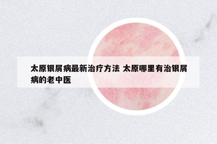 太原銀屑病最新治療方法 太原哪里有治銀屑病的老中醫(yī)