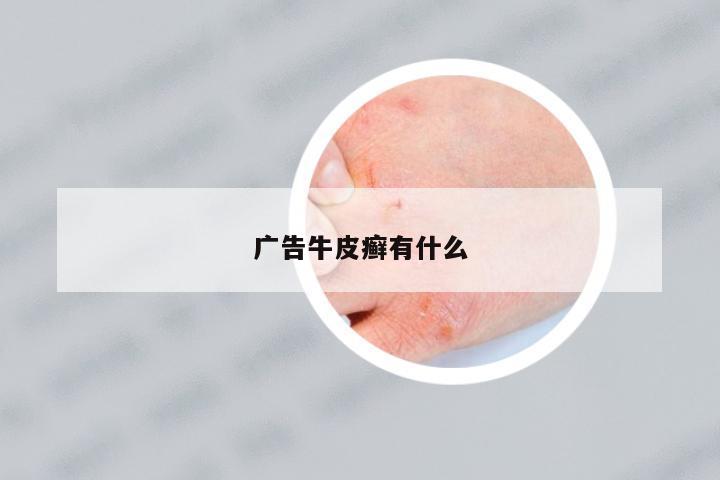 廣告牛皮癬有什么