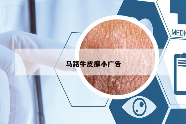 馬路牛皮癬小廣告