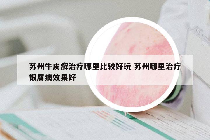 蘇州牛皮癬治療哪里比較好玩 蘇州哪里治療銀屑病效果好