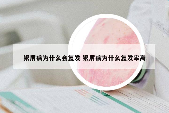 銀屑病為什么會(huì)復(fù)發(fā) 銀屑病為什么復(fù)發(fā)率高