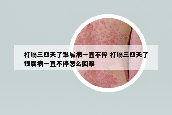 打嗝三四天了銀屑病一直不停 打嗝三四天了銀屑病一直不停怎么回事