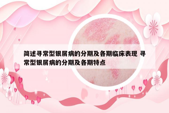 簡(jiǎn)述尋常型銀屑病的分期及各期臨床表現(xiàn) 尋常型銀屑病的分期及各期特點(diǎn)