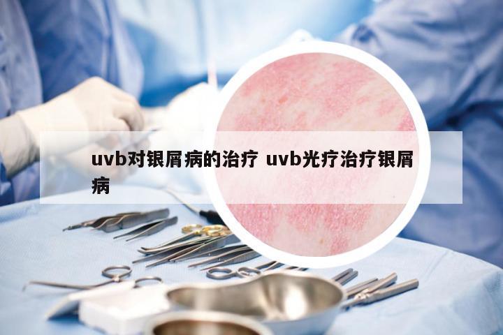 uvb對銀屑病的治療 uvb光療治療銀屑病