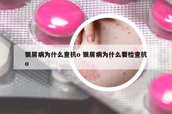 銀屑病為什么查抗o 銀屑病為什么要檢查抗o