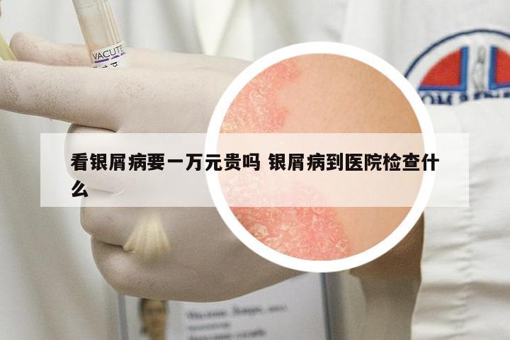 看銀屑病要一萬(wàn)元貴嗎 銀屑病到醫(yī)院檢查什么