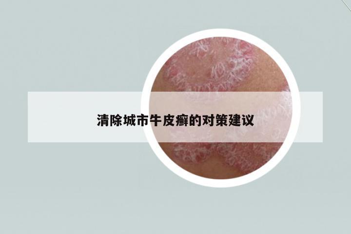 清除城市牛皮癬的對(duì)策建議