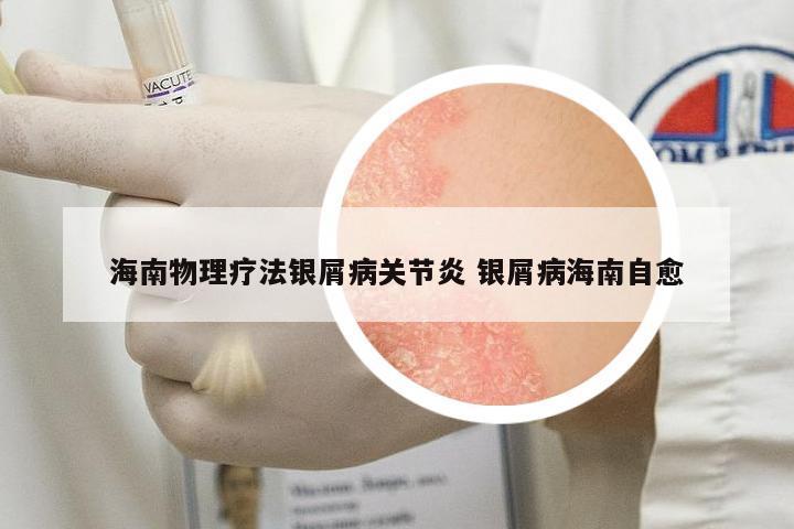 海南物理療法銀屑病關(guān)節(jié)炎 銀屑病海南自愈