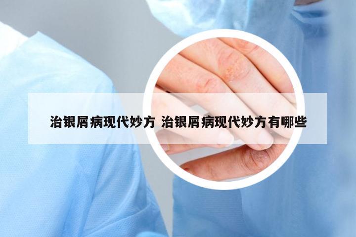 治銀屑病現(xiàn)代妙方 治銀屑病現(xiàn)代妙方有哪些