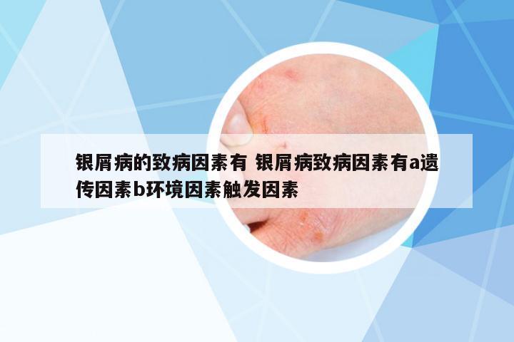 銀屑病的致病因素有 銀屑病致病因素有a遺傳因素b環(huán)境因素觸發(fā)因素