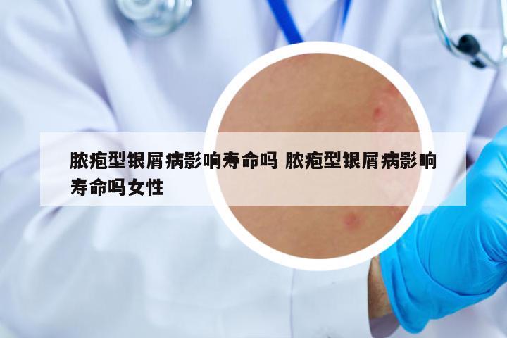 膿皰型銀屑病影響壽命嗎 膿皰型銀屑病影響壽命嗎女性