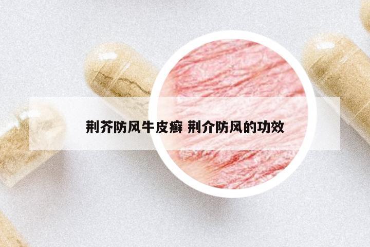荊芥防風(fēng)牛皮癬 荊介防風(fēng)的功效