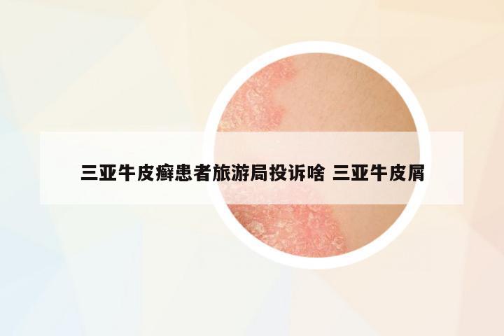 三亞牛皮癬患者旅游局投訴啥 三亞牛皮屑