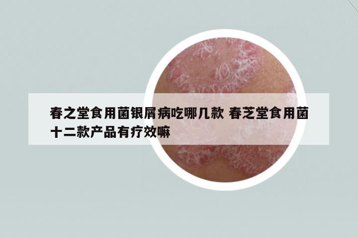 春之堂食用菌銀屑病吃哪幾款 春芝堂食用菌十二款產(chǎn)品有療效嘛