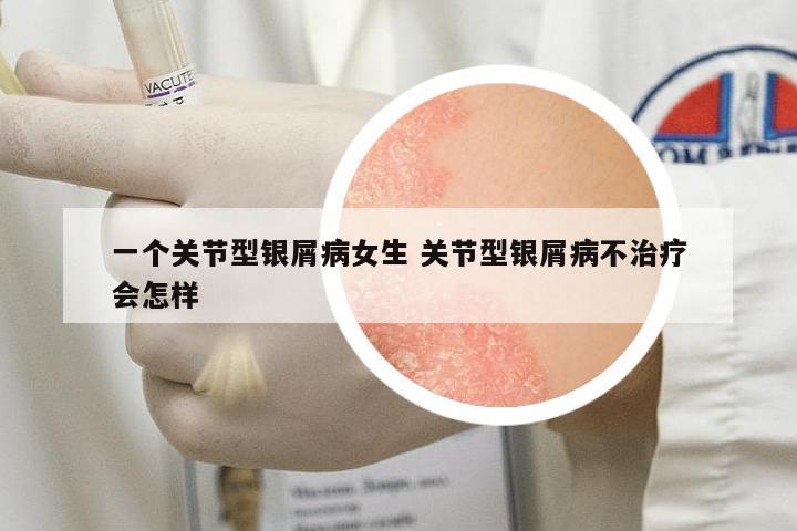 一個關(guān)節(jié)型銀屑病女生 關(guān)節(jié)型銀屑病不治療會怎樣