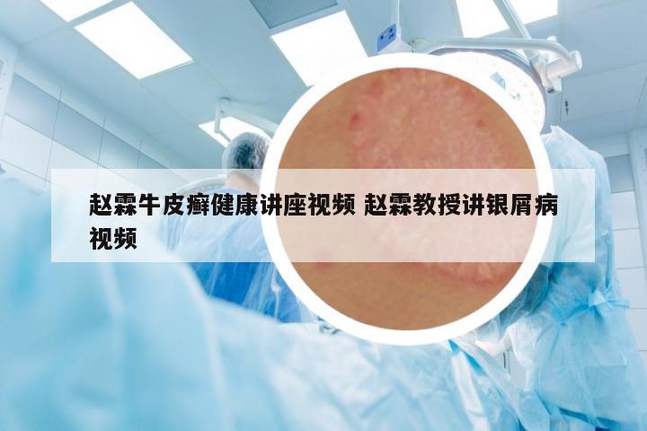 趙霖牛皮癬健康講座視頻 趙霖教授講銀屑病視頻