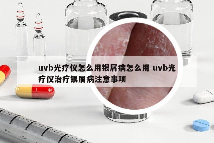 uvb光療儀怎么用銀屑病怎么用 uvb光療儀治療銀屑病注意事項(xiàng)