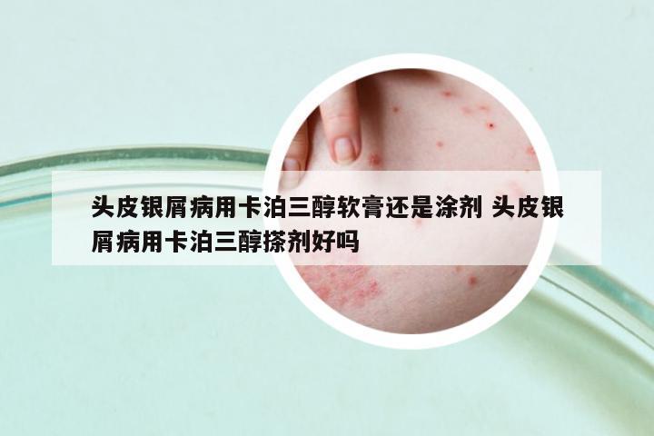 頭皮銀屑病用卡泊三醇軟膏還是涂劑 頭皮銀屑病用卡泊三醇搽劑好嗎
